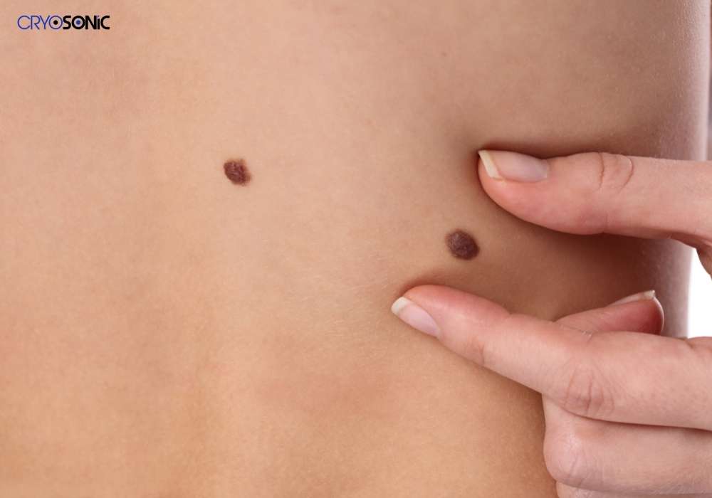Infection Risk and Poor Aftercare Milton Keynes