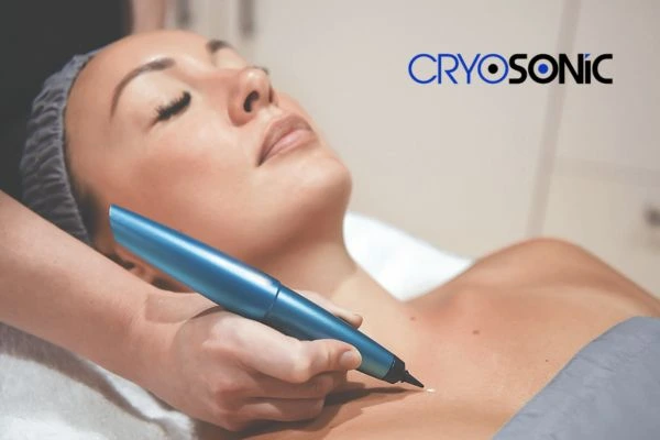 Cryosonic lesion removal prices book today! Milton Keynes