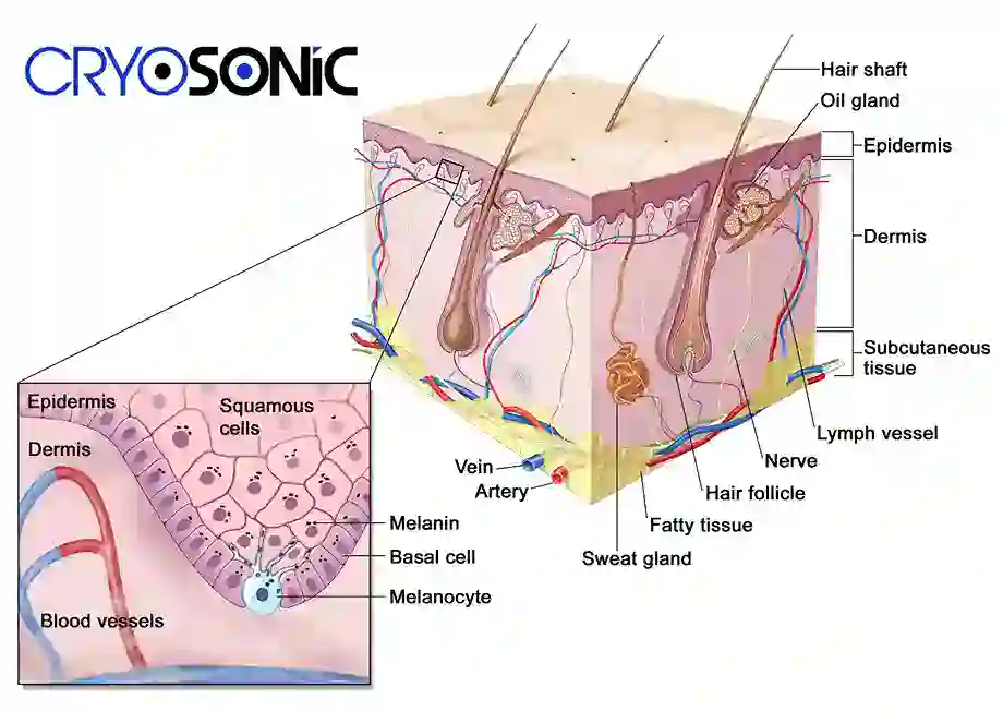 How Cryotherapy Stimulates Melanocyte Activity Milton Keynes